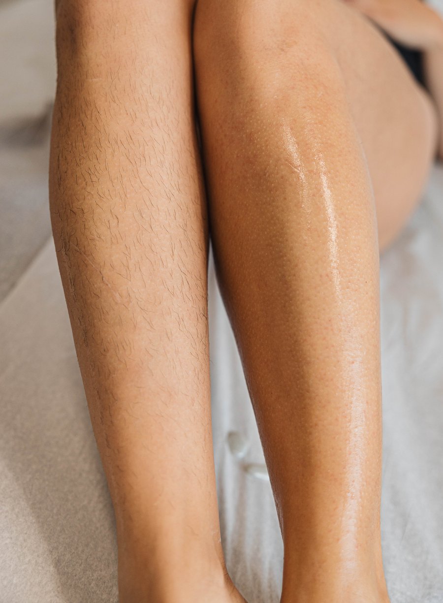One leg before waxing with visible hair beside a freshly waxed, smooth leg